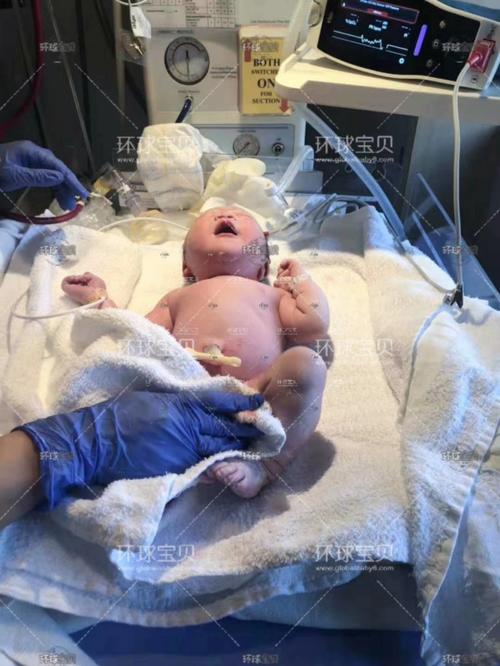 出生在加拿大福利待遇怎么样